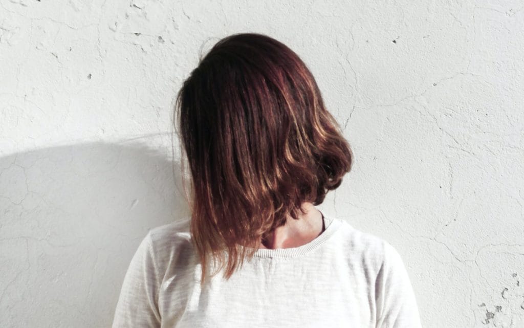 Alopecia