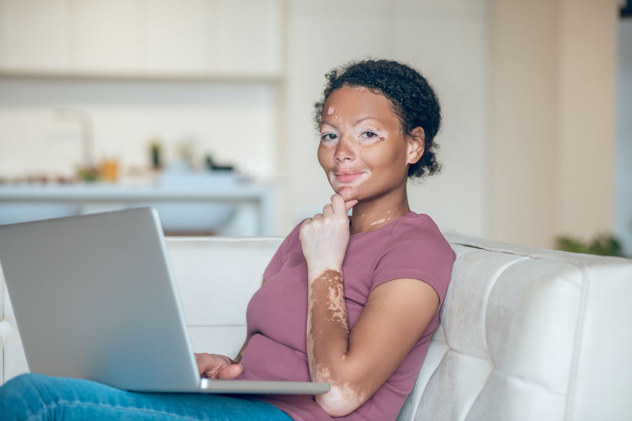 Is-Vitiligo-An-Autoimmune-Disease--Understanding-The-Immune-Connection-To-This-Skin-Condition
